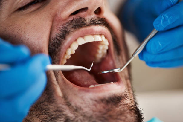 Dentist for Dental Trauma in IA